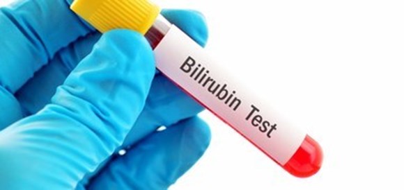 בדיקת רמות בילירובין בדם (Bilirubin) - תמונה